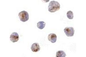 Immunocytochemistry of CARD8 in K562 cells with AP30184PU-N CARD8 antibody at 10 μg/ml. (CARD8 antibody)
