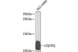 Western blot analysis of extracts of H460 cells using UQCRQ Polyclonal Antibody at dilution of 1:1000. (UQCRQ antibody)