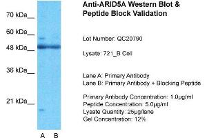 721_B; Host: Rabbit. (ARID5A antibody  (N-Term))