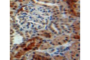 Used in DAB staining on fromalin fixed paraffin-embedded kidney tissue (PPIB antibody  (AA 34-216))