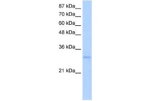 EXOSC6 antibody used at 5 ug/ml to detect target protein. (EXOSC6 antibody  (N-Term))