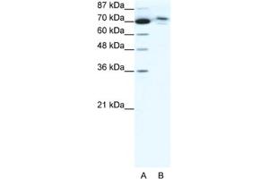 Western Blotting (WB) image for anti-Chromosome 14 Open Reading Frame 101 (C14orf101) antibody (ABIN2460921) (C14orf101 antibody)