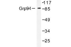 Image no. 2 for anti-Heat Shock Protein 90kDa beta (Grp94), Member 1 (HSP90B1) antibody (ABIN265448)