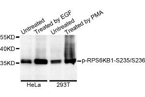 Western blot analysis of extracts of various cell lines, using Phospho-RPS6KB1-S235/236 antibody. (RPS6KB1 antibody)