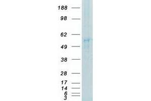 Validation with Western Blot (FYN Protein (Transcript Variant 2) (Myc-DYKDDDDK Tag))
