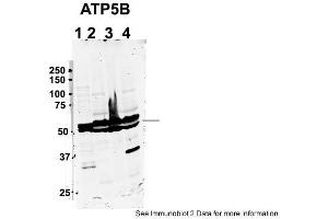 Sample Type: 1. (ATP5B antibody  (C-Term))
