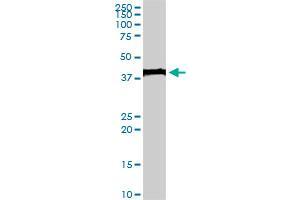 EVX1 monoclonal antibody (M07), clone 1B7. (EVX1 antibody  (AA 2-110))