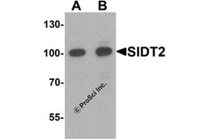 Western Blotting (WB) image for anti-SID1 Transmembrane Family, Member 2 (SIDT2) (N-Term) antibody (ABIN1077417) (SIDT2 antibody  (N-Term))