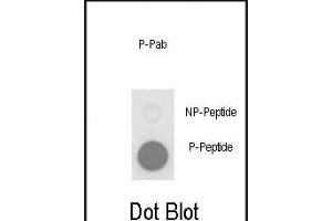 Dot blot analysis of anti-Phospho-PLB-T17 Phospho-specific Pab (ABIN650834 and ABIN2839801) on nitrocellulose membrane. (Phospholamban antibody  (pThr17))