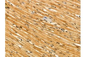 Phospho-Casein Kinase 1 alpha (Tyr294) Antibody at 1/100 staining Rat heart tissue by IHC-P.