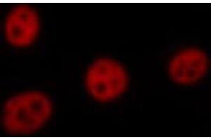 ABIN6267423 staining HeLa by IF/ICC. (ELK1 antibody  (pSer383))