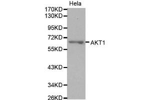 Western Blotting (WB) image for anti-V-Akt Murine Thymoma Viral Oncogene Homolog 1 (AKT1) antibody (ABIN1876708) (AKT1 antibody)