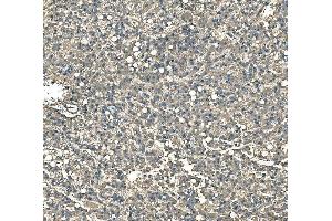 IHC analysis of Serum Amyloid P/APCS using anti-Serum Amyloid P/APCS antibody (ABIN5693182). (APCS antibody  (AA 20-220))