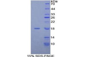 SDS-PAGE (SDS) image for NADH Dehydrogenase (Ubiquinone) 1, alpha/beta Subcomplex, 1, 8kDa (NDUFAB1) protein (ABIN3008112)