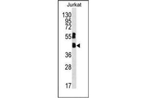 Western blot analysis of MAFB Antibody (C-term) in Jurkat cell line lysates (35ug/lane).
