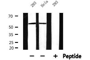 CYP17A1 antibody  (Internal Region)