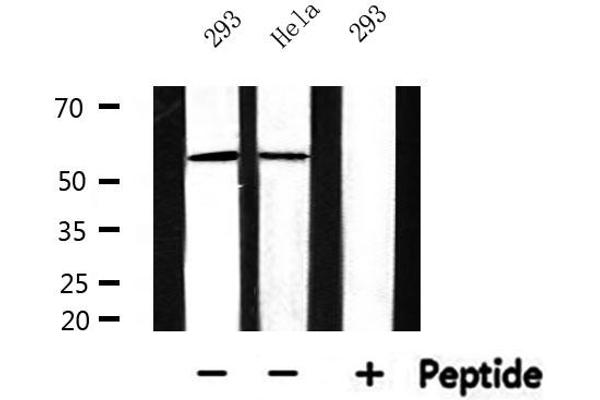 CYP17A1 antibody  (Internal Region)