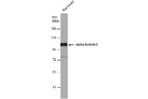 WB Image alpha Actinin 2 antibody detects alpha Actinin 2 protein by western blot analysis. (ACTN2 antibody)