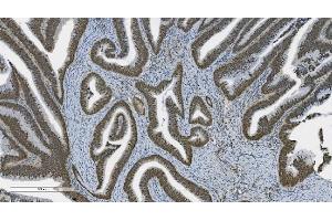 IHC analysis of PARP using anti-PARP antibody (ABIN7602278). (PARP1 antibody  (AA 670-858))