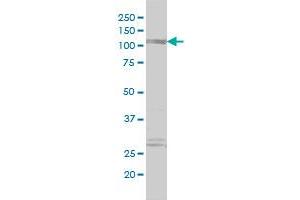 PDE4DIP antibody  (AA 1-177)