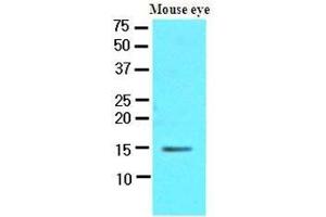 Western Blotting (WB) image for anti-Cellular Retinoic Acid Binding Protein 1 (CRABP1) (AA 1-137), (N-Term) antibody (ABIN400871) (CRABP1 antibody  (N-Term))