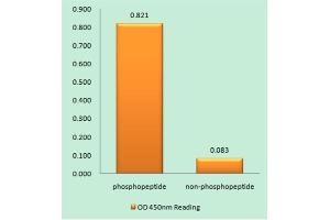 Immunohistochemistry analysis of paraffin-embedded human brain tissue using NMDAR1 (Phospho-Ser890) antibody. (GRIN1/NMDAR1 antibody  (pSer890))