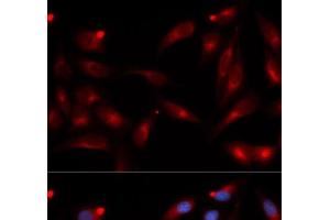 Immunofluorescence analysis of U2OS cells using ADAM9 Polyclonal Antibody (ADAM9 antibody)
