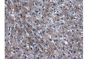 Immunohistochemical staining of paraffin-embedded liver tissue using anti-AKT2mouse monoclonal antibody. (AKT2 antibody)