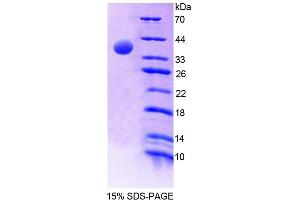 SDS-PAGE analysis of Human EPB41 Protein. (EPB41 Protein)