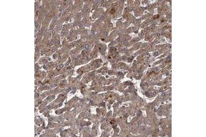 Immunohistochemical staining (Formalin-fixed paraffin-embedded sections) of human liver with UNC93B1 polyclonal antibody  shows strong cytoplasmic positivity in hepatocytes. (UNC93B1 antibody)