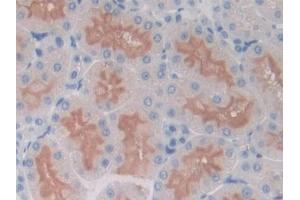 DAB staining on IHC-P; Samples: Rat Kidney Tissue (ICOS antibody  (AA 39-133))