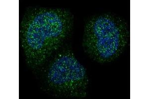 Immunofluorescent analysis of Hela cells, using Cyclin B1 Antibody . (Recombinant Cyclin B1 antibody)