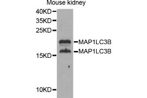Western blot analysis of extracts of mouse kidney, using MAP1LC3B antibody (ABIN5973262) at 1/1000 dilution.