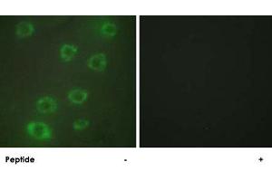 Immunofluorescence analysis of HUVEC cells, using PTX3 polyclonal antibody . (PTX3 antibody  (N-Term))