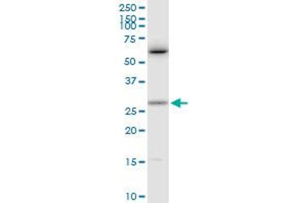 Cardiotrophin 1 antibody  (AA 1-201)