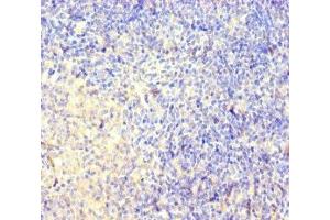 Immunohistochemistry of paraffin-embedded human pancreatic tissue using ABIN7148826 at dilution of 1:100 (CNGA4 antibody  (AA 1-575))