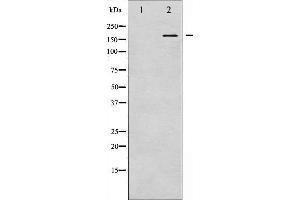 Western blot analysis of NMDAR2B phosphorylation expression in UV treated Jurkat whole cell lysates,The lane on the left is treated with the antigen-specific peptide. (GRIN2B antibody  (pTyr1474))