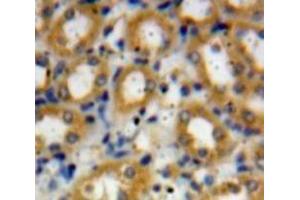 Used in DAB staining on fromalin fixed paraffin-embedded Liver tissue (C4A antibody  (AA 680-756))