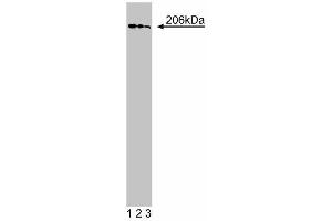 Western blot analysis of GBF1 on a HeLa cell lysate (Human cervical epitheloid carcinoma, ATCC CCL-2.