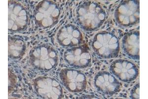 Detection of Cys-C in Human Intestine Tissue using Polyclonal Antibody to Cystatin C (Cys-C) (Cystathionine-gamma-Synthase Precursor (CYS) (AA 27-146) antibody)