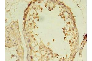 Immunohistochemistry of paraffin-embedded human testis tissue using ABIN7160198 at dilution of 1:100 (MORC2 antibody  (AA 2-300))