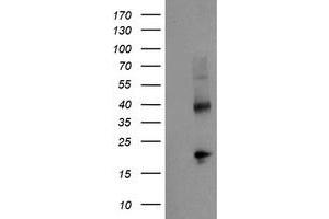 HEK293T cells were transfected with the pCMV6-ENTRY control (Left lane) or pCMV6-ENTRY TBCC (Right lane) cDNA for 48 hrs and lysed. (TBCC antibody)
