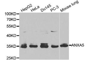 Western blot analysis of extracts of various cell lines, using ANXA5 antibody. (Annexin V antibody  (AA 1-320))