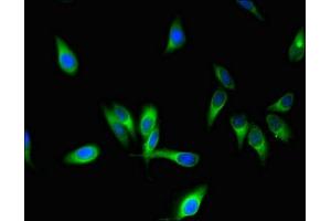 Immunofluorescent analysis of Hela cells using ABIN7170721 at dilution of 1:100 and Alexa Fluor 488-congugated AffiniPure Goat Anti-Rabbit IgG(H+L) (Stathmin 1 antibody  (AA 13-78))