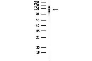 anti-Heterogeneous Nuclear Ribonucleoprotein U-Like 1 (HNRNPUL1) (C-Term) antibody
