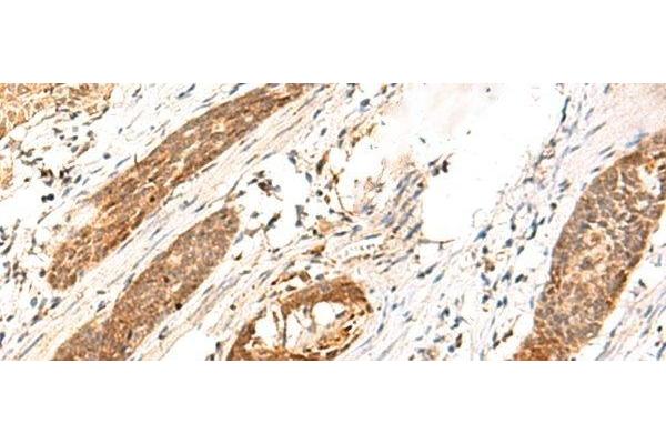 DCAF10 antibody