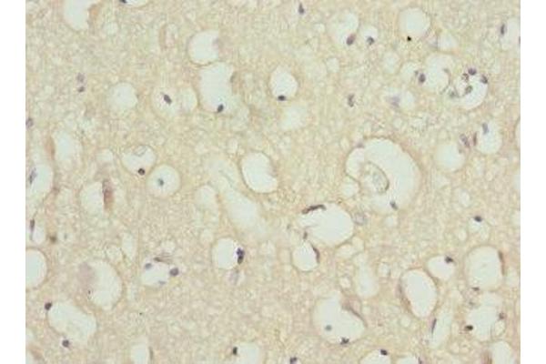 SCN2B antibody  (AA 30-160)