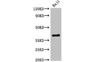 Western Blot Positive WB detected in: Raji whole cell lysate All lanes: HMBS antibody at 3 μg/mL Secondary Goat polyclonal to rabbit IgG at 1/50000 dilution Predicted band size: 40, 38, 35, 34 kDa Observed band size: 40 kDa