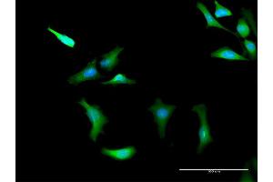 Immunofluorescence of purified MaxPab antibody to PRKAG2 on HeLa cell.