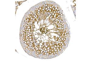 Immunohistochemistry of paraffin-embedded rat testis using GLUT3/SLC2 Rabbit pAb (ABIN6134111, ABIN6147961, ABIN6147962 and ABIN6224173) at dilution of 1:50 (40x lens). (SLC2A3 antibody  (AA 150-250))